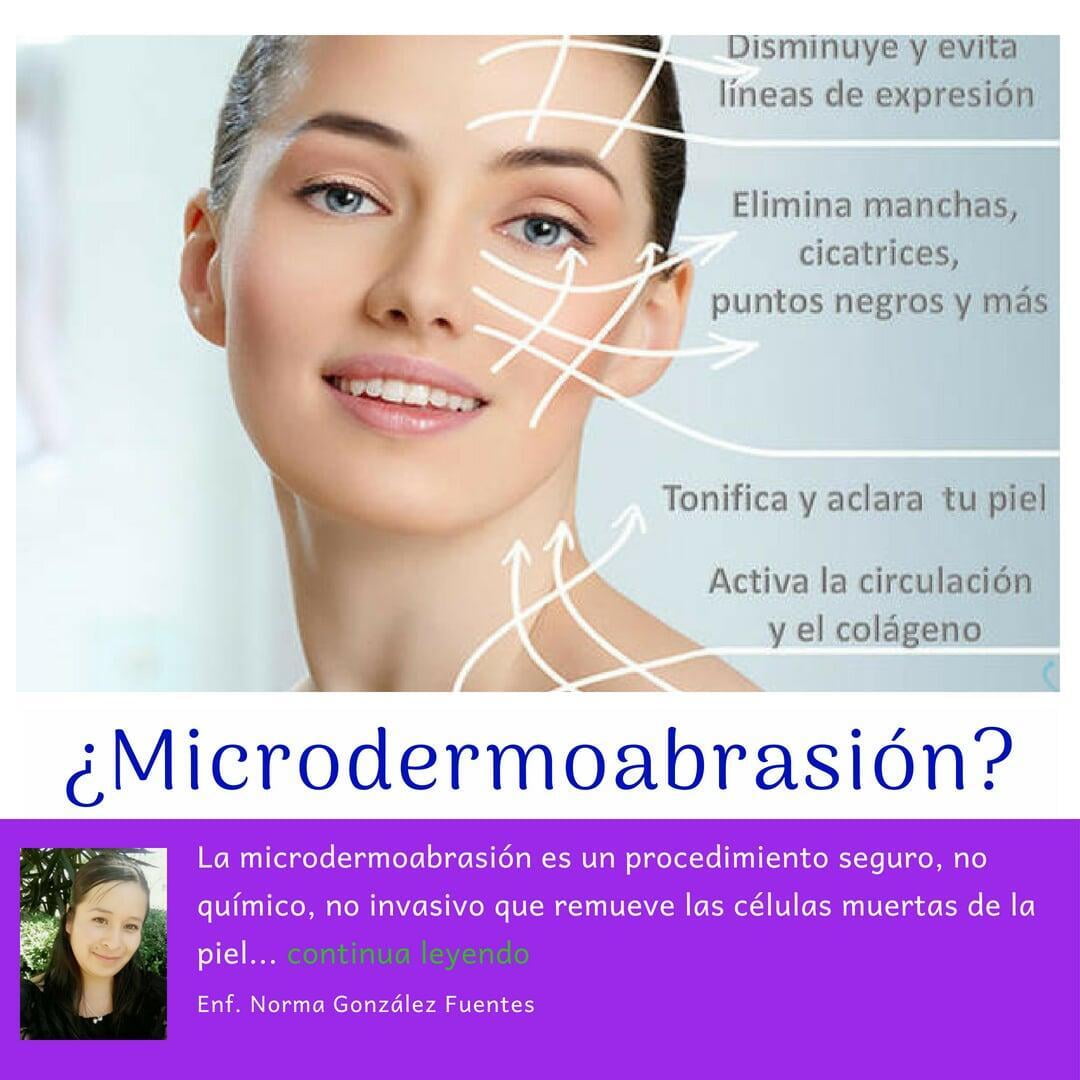 Microdermoabrasión